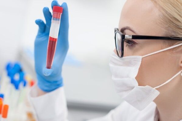 Test de sânge pentru hipertensiune arterială
